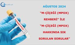 Ağustos 2024 M-Çiçeği (MPox) Rehberi” ile “M-Çiçeği (MPox) Hakkında Sık Sorulan Sorular”